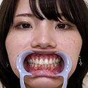 【歯フェチ】河合陽菜ちゃんの歯を観察しました!