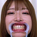 【歯フェチ】葉月ひなちゃんの歯を観察しました!