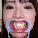 【歯フェチ】橘内ひなたさんの歯を観察しました!