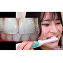 【歯フェチ】特別企画! 岩沢香代さんの歯・口内・喉奥を歯科用カメラで観察