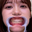 【歯フェチ】小野寺舞ちゃんの歯を観察しました!