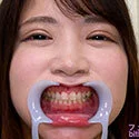 【歯フェチ】秋月まりなちゃんの歯を観察しました!