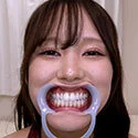 【歯フェチ】碓井せりなちゃんの歯を観察しました!