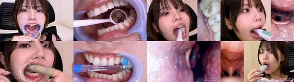 河合陽菜の歯観察 特別企画シリーズ1～2まとめてDL
