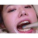 【歯フェチ】特別企画! 川越ゆいさんの歯をデンタルミラーで観察&開口器着けながら