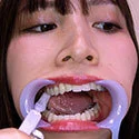 【歯フェチ】特別企画! 南條彩さんの歯をデンタルミラーで観察&開口器着けながら歯