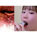 【歯フェチ】特別企画! 藤田ゆずさんの歯・口内・喉奥を歯科用カメラで観察