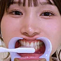 【歯フェチ】特別企画! 由良かなちゃんの歯をデンタルミラーで観察&開口器着けなが